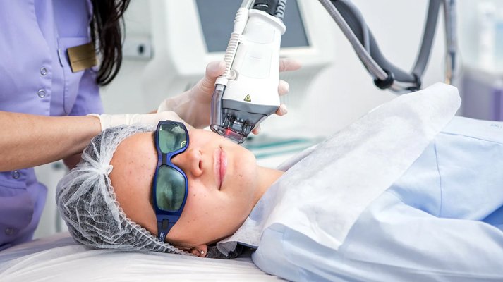 IPL Photo Facial